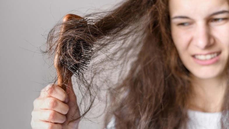 Say Goodbye to Dandruff: Tips for a Healthy Scalp.